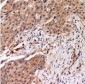 Phospho-MYPT1 (Thr696) Antibody